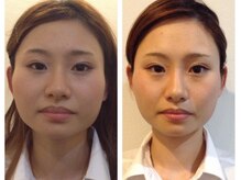 リバース(Re birth)の雰囲気（首肩周りのリンパマッサージと骨格から整える小顔矯正でスッキリ）