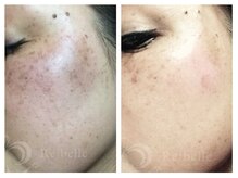 パルファンカルム 駅西本町店/早く試せばよかった...