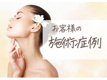 ルミエール(lumiere)/