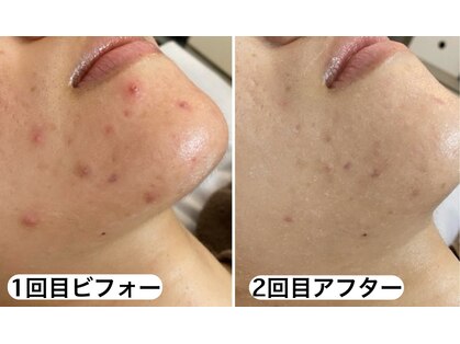 ラ リノ 星ヶ丘(La Lino)の写真