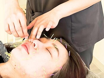 ビハリスト 麻布十番の写真/麻布十番で身体の悩み解消！美容鍼灸でたるみ改善＆むくみ解消、小顔を手に入れるオーダーメイドコース