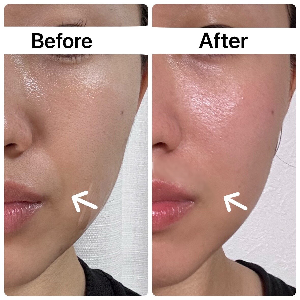 新潟市東区でフェイシャルエステが人気のエステサロン｜ホットペッパー