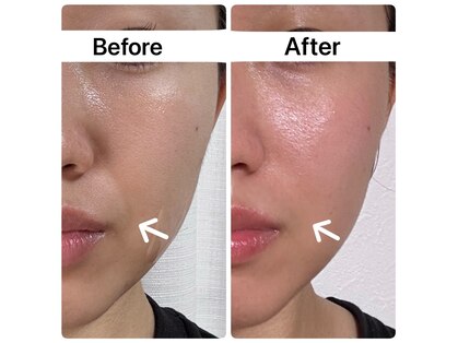 バイオ スキン プラス(Bio Skin Plus)の写真