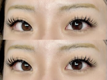 リジェネ(Regene)/バインドロック