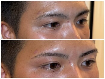 スリーピース(3Peace)/アーチ眉 Before/After