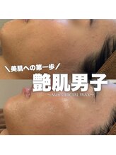 ジェノール 2nd beauty studio 姫路駅前店(JNOEL)/美肌への第一歩！艶肌男子