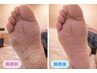 熟練技術で行う 本格角質ケア30分★3500円