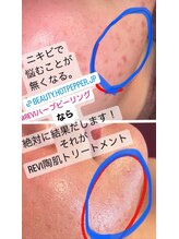スペチアーレ 夙川/赤ちゃんの様な陶器肌に