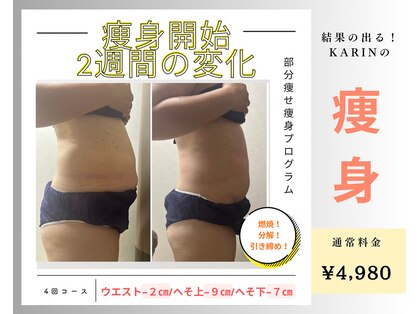 カリン(KA RiN)の写真