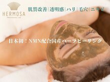 アリュメント(Allument)