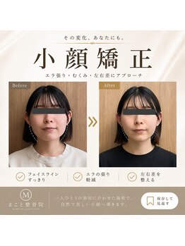 まこと整体院 新鳥栖店の写真/むくみ・フェイスラインが気になる方へ。身体の姿勢から整える小顔矯正♪