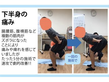 セルフケア整体 新宿店/実際のお客様◆1来店 下半身痛み