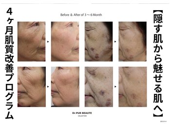 フェリス(FELIZ)/人生を変えるお化粧品