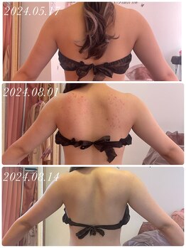 サロンジー(Salon Gee)/ブライダル痩身