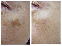 パルファンカルム 駅西本町店/意識の高い女性が選ぶ理由。