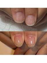 キュア(Cure.)/もちのいいジェルネイルをご希望