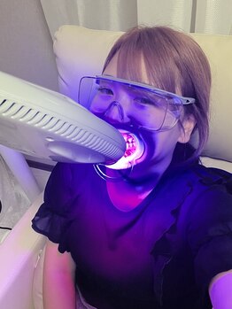 アルヒ(ALUHI)/セルフホワイトニング