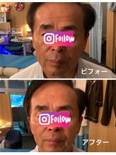 ルクシア(Luxia)/高齢者