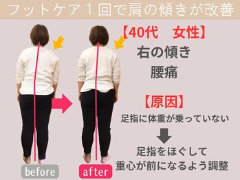 西宮かなで整体院/話題の足指ほぐしで歪み改善
