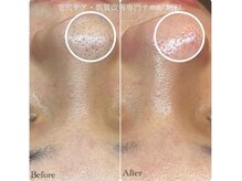 ピエル 北千住店(PIEL)/お得なキャンペーン