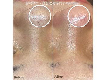 ピエル 北千住店(PIEL)/お得なキャンペーン