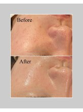 ブラックボックス(BLACK BOX)/20代女性のお客様