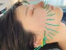 【今月限定☆】クイックEMS(電気)美容鍼コース 30分/5000
