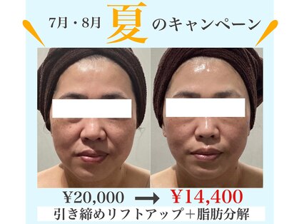 レイジュ(reiju)の写真