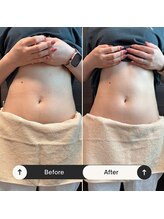 スルリ(sururi)/むくみ・張りがスッキリ