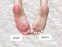 わたしのネイルとよもぎ蒸し/