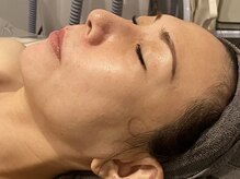 ラルミエール 緑店はなれ(la lumiere)/肌質改善！リゼネレート
