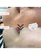 ジュエルカラーズ(JEWEL COLORS)の写真/【シミしわ改善】あきらめていた肌悩みに。とげの力でターンオーバーを促進し未来の美肌を作る◎