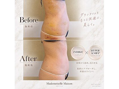 マドモアゼルメゾン 恵比寿(マドモアゼルMaison)の写真