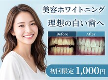 セルフメイド 山大通り店(SELFMADE)の雰囲気（美容ホワイトニングも♪）