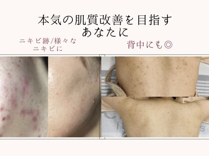 ヴィヴィ(ViVi)の写真