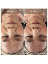 マシュマロヘッド 目黒店(Mashumaro Head)/超高濃度ヒト幹細胞培養液導入☆