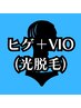 【光】ヒゲ＋VIO脱毛◆◇メンズ脱毛