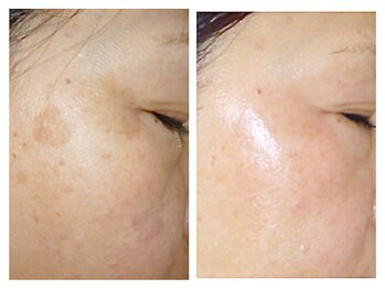 パルファンカルム 駅西本町店/肌を諦めないでください!