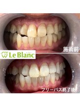 ルブラン 奈良店(Le Blanc)/1日で着色するの！？