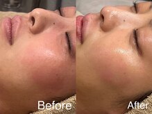 シェリーミル(Cherie Miru)/赤みケア/鎮静/保湿