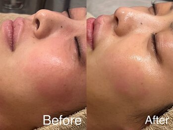 シェリーミル(Cherie Miru)/赤みケア/鎮静/保湿