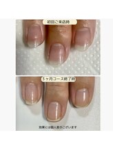 ルームイチマルイチネイルズ(Room101Nails.)/自爪育成・最強のネイルケア鳥取