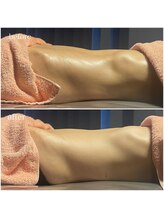 ミミ(MIMI)/【ダイエット】お腹・くびれ作り