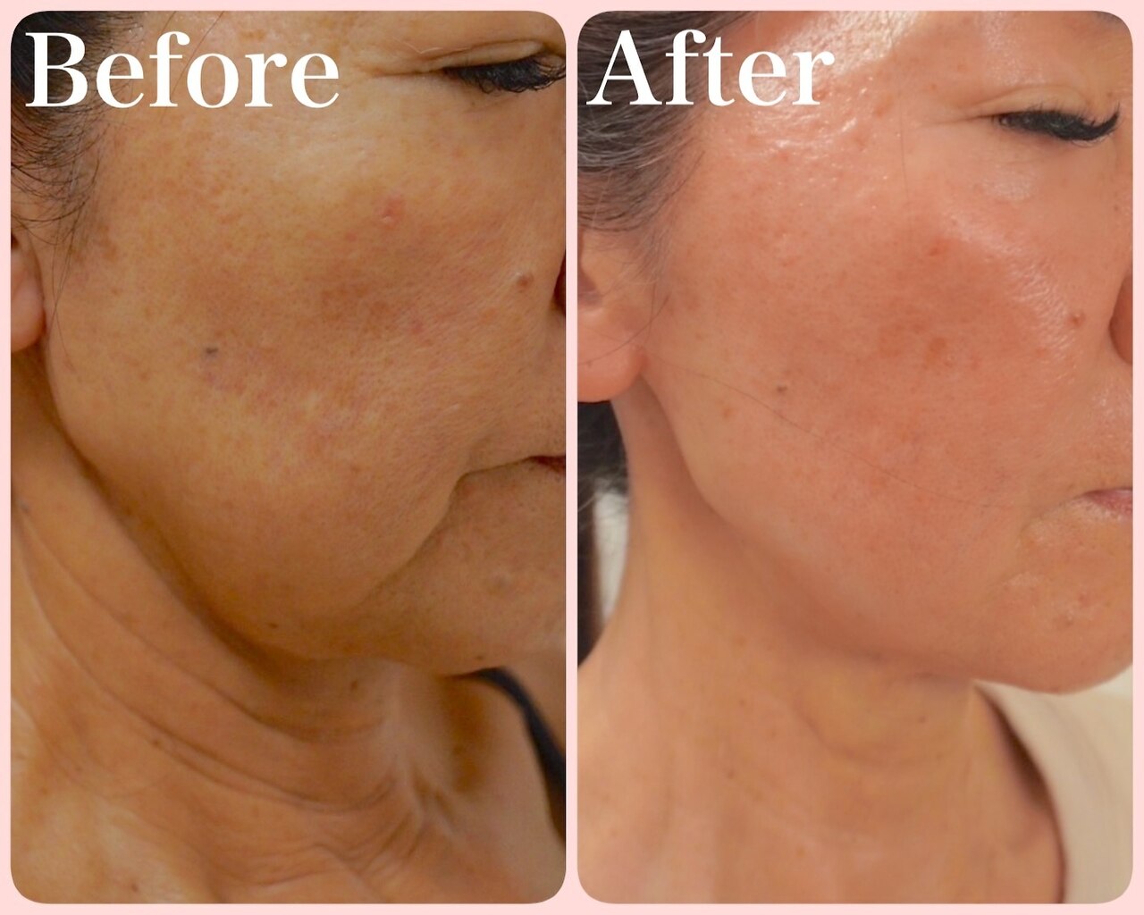 トータルビューティサロン クイーン(Queen)｜ホットペッパービューティー