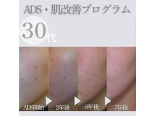 エステティックサロン フィール(feel)の雰囲気（30代～のシミ、シワ、タルミ、肌荒れを得意としています♪）