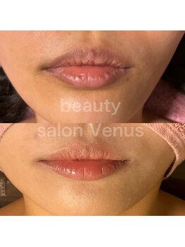 ヴィーナス(Venus)/ローマピンク