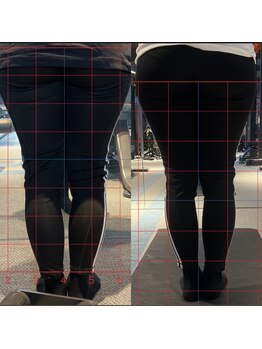 ハーモニーフィットネス 赤坂(Harmony Fitness)/むくみ改善