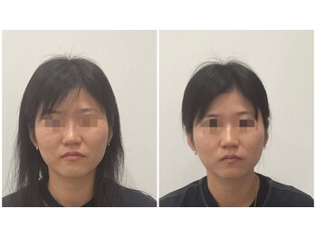 リシュレータ(RISYURE-TA)/