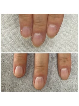 ステラ ネイルスタジオ(STELLA)/バレない自爪育成やってます!