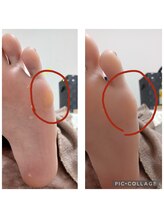 遊歩堂/小指下タコ